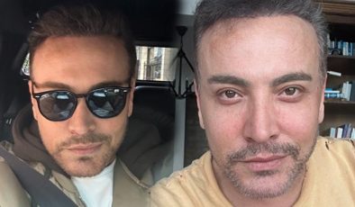 Estetik operasyonunun ardından Cenk Eren’e nazar değdi